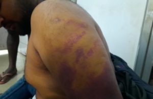 ପ୍ରେମିକା ଘରେ ମାଡ ଖାଇ ପ୍ରେମିକ ମେଡିକାଲରେ