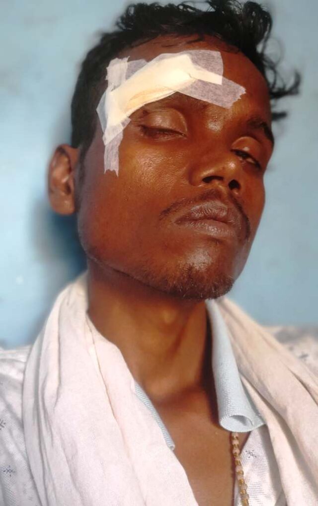 ADIBASI JUBAKAKU MARANANTAKA AKRAMANA