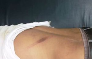 ସାମ୍ବାଦିକଙ୍କ ଦାଦାଗିରି, ସର୍ବ ସମୁଖରେ ଯୁବକଙ୍କୁ ମାଡ ମାରିବା ସହ ସୁନା ଚେନ ଛିଡାଇ ନେଇଥିବା ଥାନାରେ ଅଭିଯୋଗ