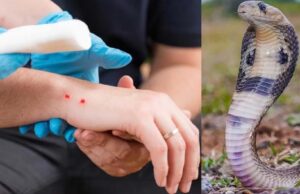 ସାପ କାମୁଡାରେ ଏବେବି ଗୁଣିଗାରେଡି ପରମ୍ପରା ବଜାୟ ରହିଛି, ସାଢେ ଚାରିବର୍ଷ ମଧ୍ୟରେ ୧୫୯ ଜଣଙ୍କର ମୃତ୍ୟୁ