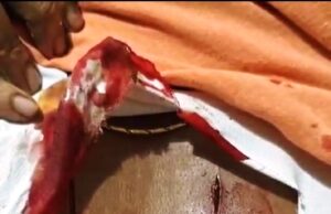 ବିଜେପି ନେତ୍ରୀ ଏବଂ ସହଯୋଗୀଙ୍କୁ ସଂଘବଦ୍ଧ ଭାବେ ଆକ୍ରମଣ, ଜୀବନରୁ ମାରିଦେବାକୁ ଧମକ