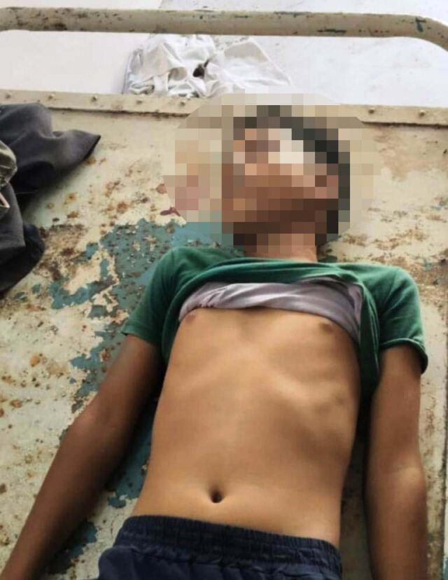 RASI LAGAI 10 YEARS CHILD DEATH