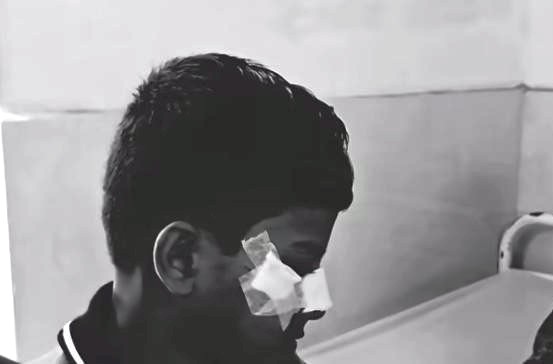 SCHOOL CHATARU FAN KHASI CHATRA AAHATA