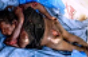 ରାଜପଥ ପାଶ୍ୱର୍ରୁ ଅଜଣା ମୃତଦେହ ଉଦ୍ଧାର